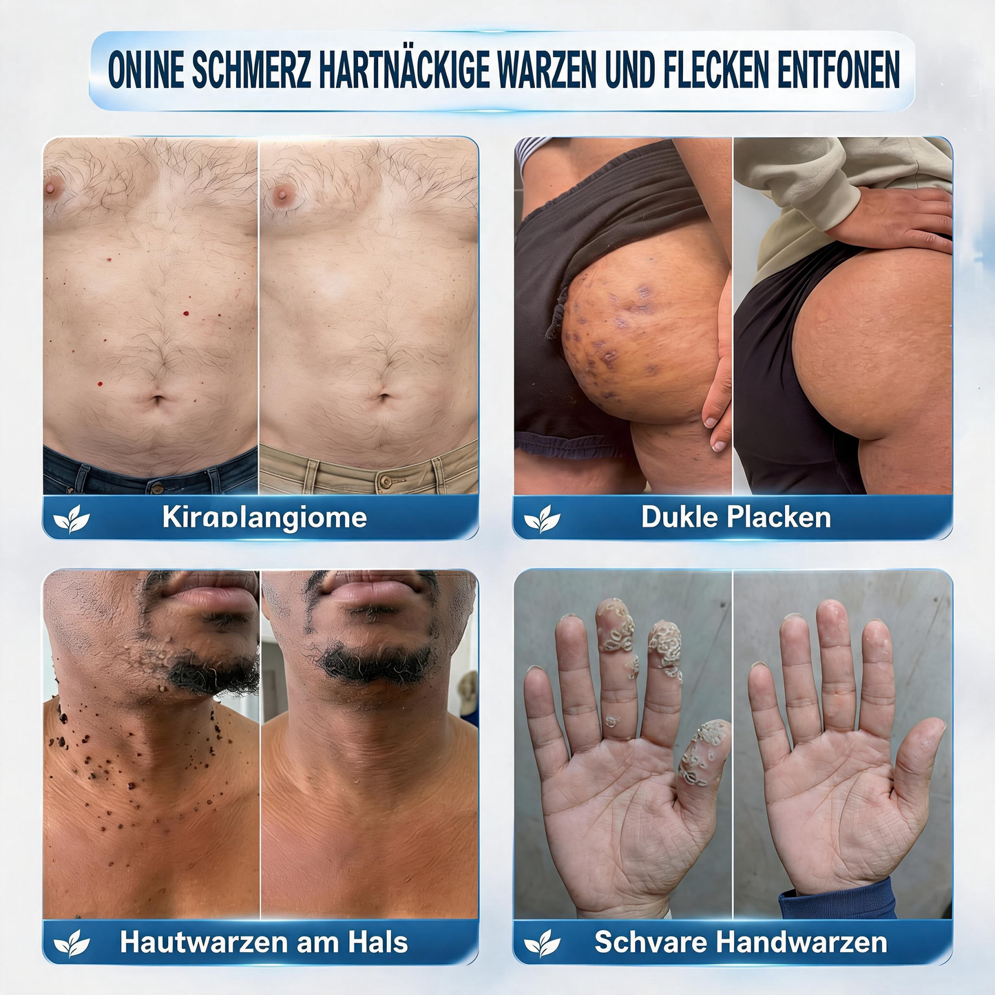 Offizieller Markenstore |✅Natravor® 7-𝑻𝒂𝒈𝒆 𝑯𝒂𝒖𝒕𝒂𝒏𝒉ä𝒏𝒈𝒔𝒆𝒍- & 𝑭𝒍𝒆𝒄𝒌𝒆𝒏𝒆𝒏𝒕𝒇𝒆𝒓𝒏𝒆𝒓(Schmerzfreier Rollerball – Keine Narbenbildung)🚀