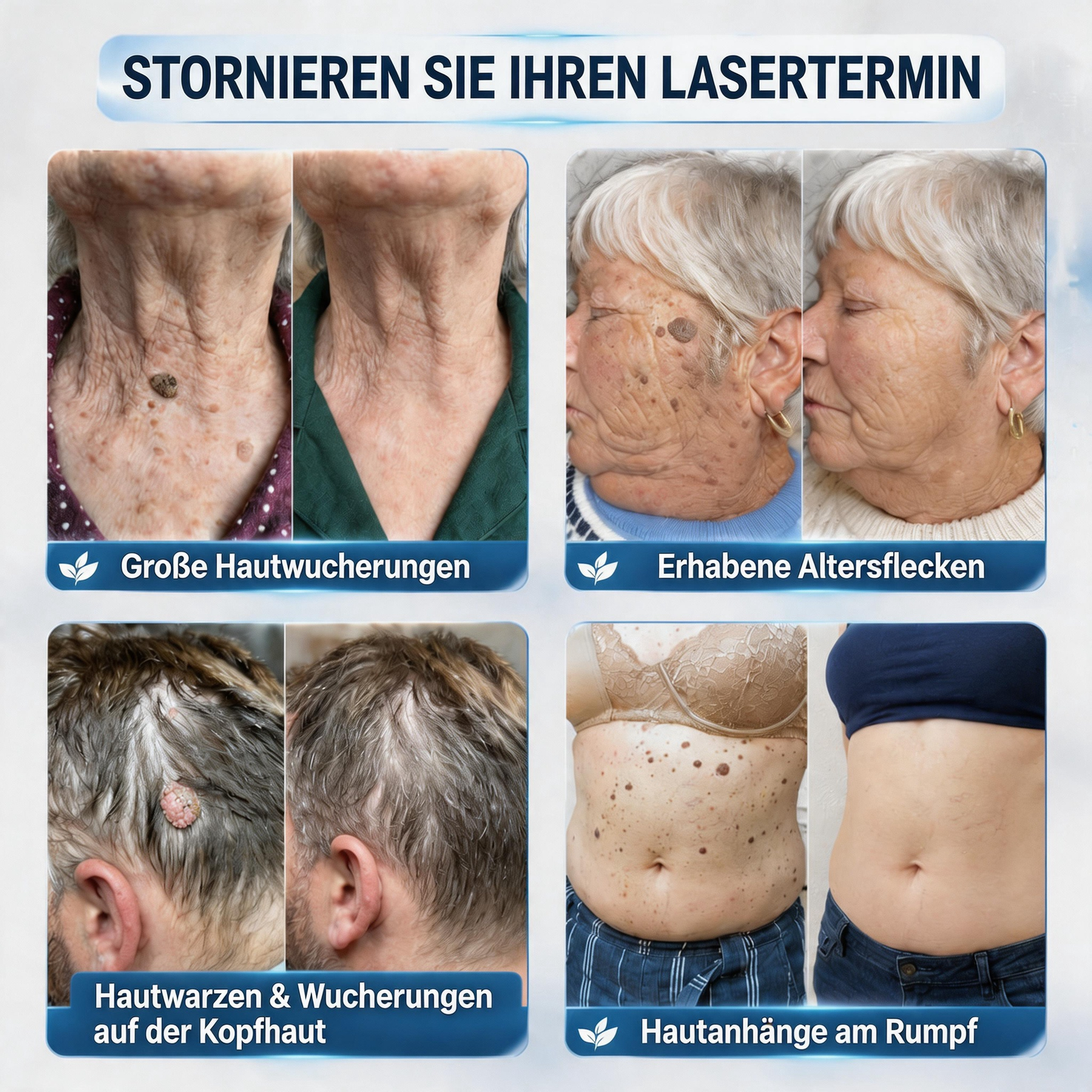 Offizieller Markenstore |✅Natravor® 7-𝑻𝒂𝒈𝒆 𝑯𝒂𝒖𝒕𝒂𝒏𝒉ä𝒏𝒈𝒔𝒆𝒍- & 𝑭𝒍𝒆𝒄𝒌𝒆𝒏𝒆𝒏𝒕𝒇𝒆𝒓𝒏𝒆𝒓(Schmerzfreier Rollerball – Keine Narbenbildung)🚀